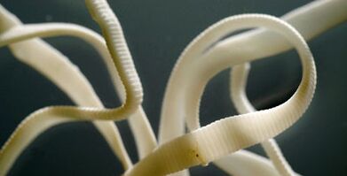 lapos parazita az emberi testből